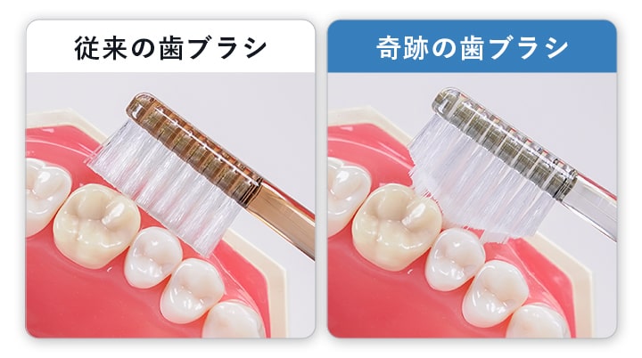 従来の歯ブラシと奇跡の歯ブラシの比較